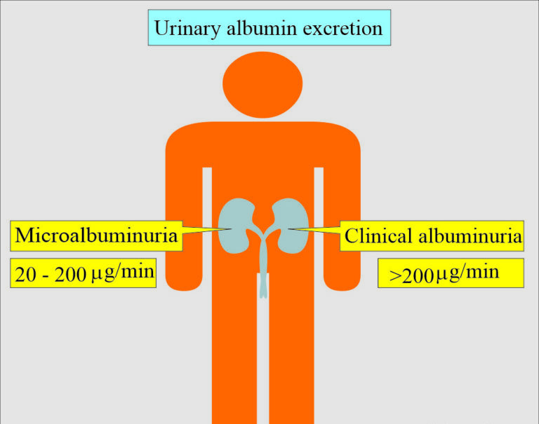 Understanding the Albumin Creatinine Ratio: A Comprehensive Guide