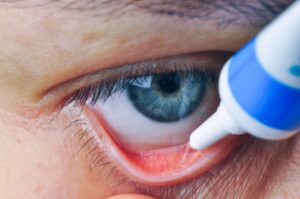 antibiotic eye drops for conjunctivitis