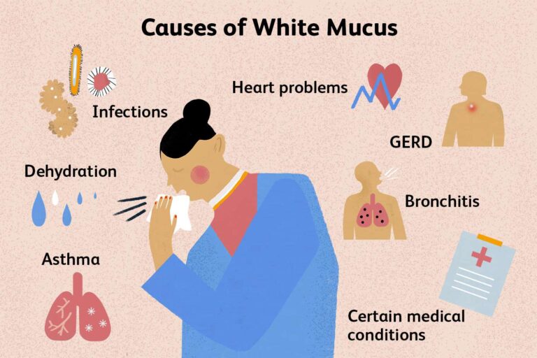 Coughing Up White Foamy Mucus Pneumonia: Understanding Symptoms, Causes, and Treatments