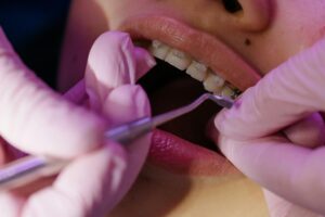 What Dentist Take Medicaid: A Comprehensive Guide