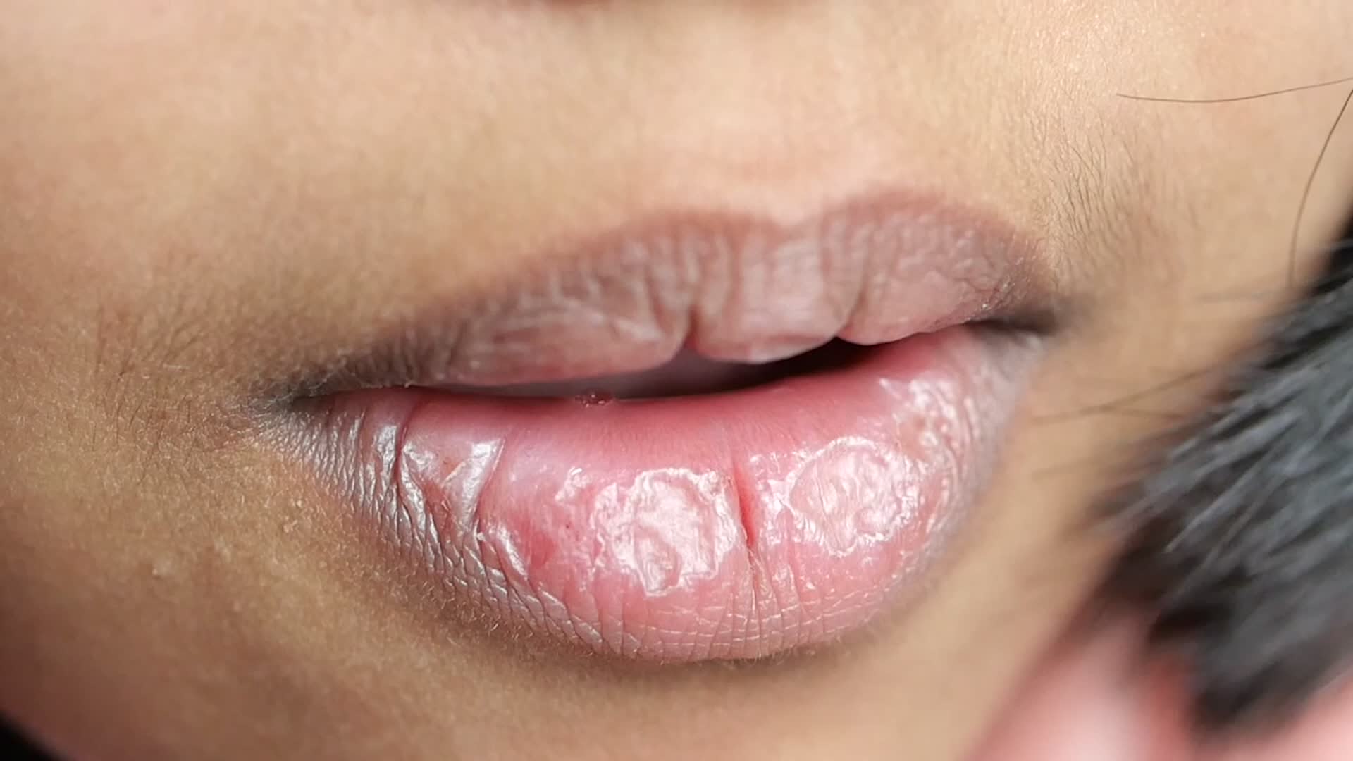 white stuff on lips