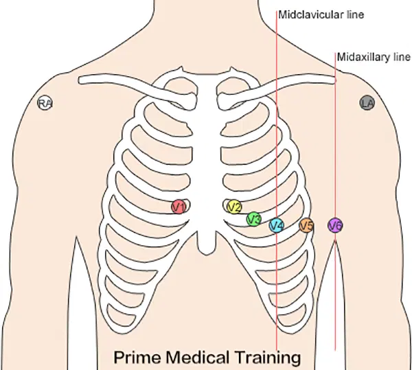 Understanding the Normal ECG Strip: A Comprehensive Guide