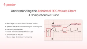 Understanding ST Elevation ECG: A Comprehensive Guide