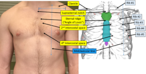 Understanding ECG Lead Placement: A Simple Guide