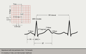 Understanding Interval QT: A Comprehensive Guide