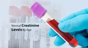 Understanding Creatinine: What It Is and Why It Matters