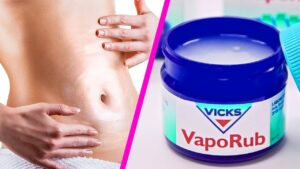 What Is Vicks VapoRub Good For? Exploring the Versatile Uses of This Household Staple