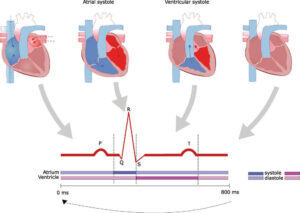 Understanding Junctional Escape Rhythm: Insights into Cardiac Function