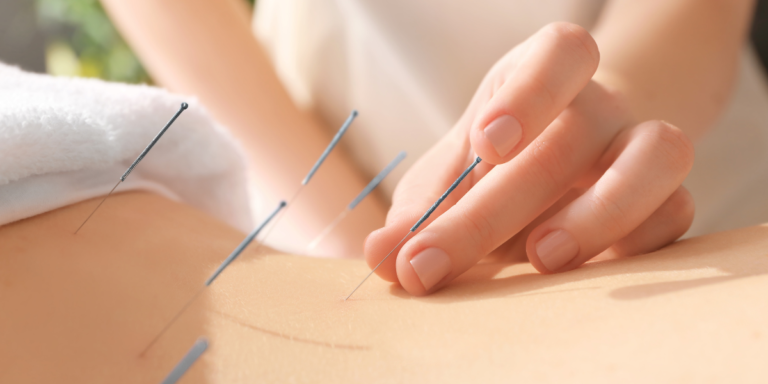 How to Master Meditation with Acupuncture: A Step-by-Step Guide for Beginners