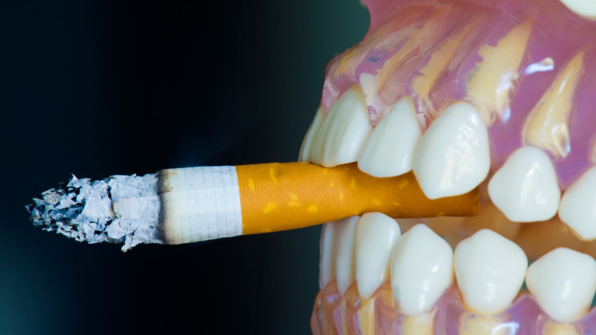 The Impact of Smoking on Your Gums and How to Reverse the Damage