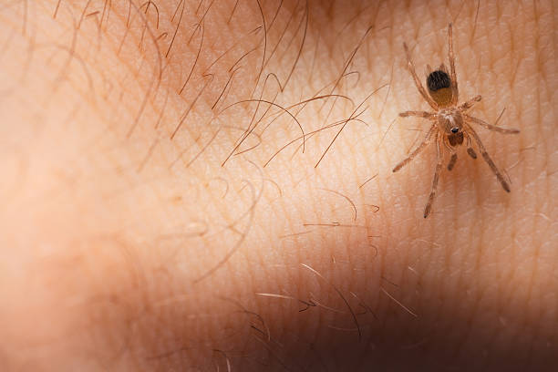 Pictures of Spider Bites: Understanding and Identifying Spider Bites